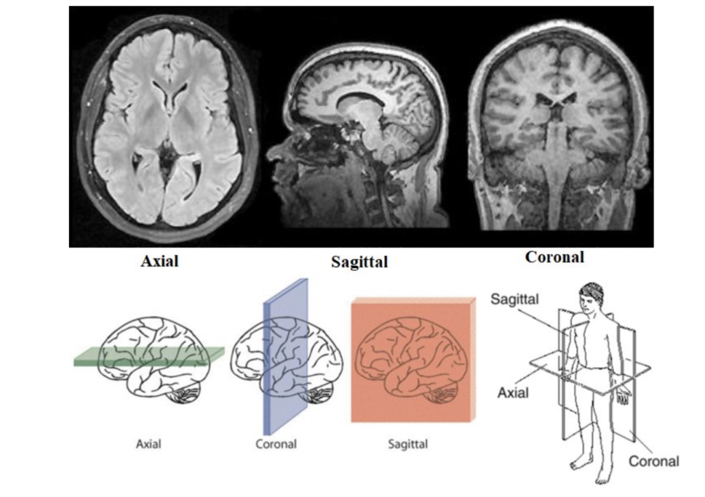 MRIs and the Biomedical Technologist/ Technician (FSE)