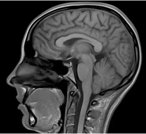 Diagnostic Imaging – MRI